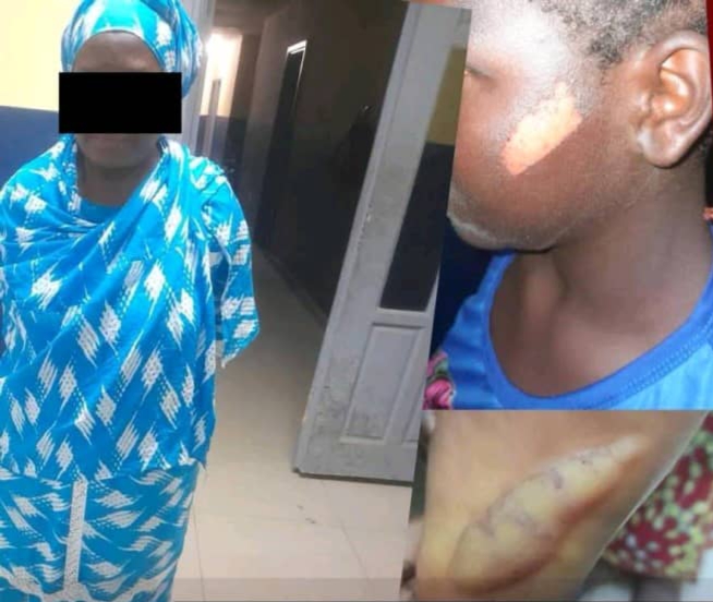 abidjan-une-fillette-brn-lnoe-au-couteau-chaud-par-sa-tante-nc-abobo-n-a-dotrno